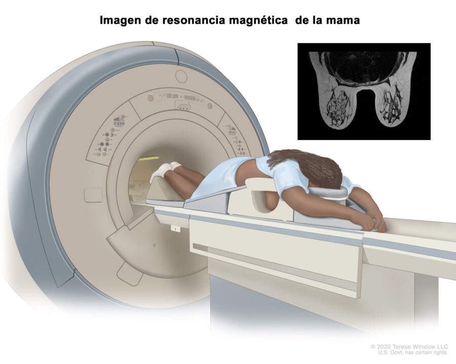 como-funciona-la-imagen-por-resonancia-magnética