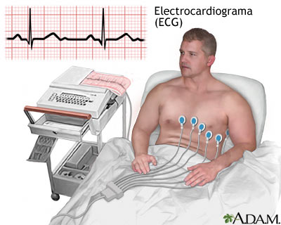 como-funciona-una-máquina-de-electrocardiograma